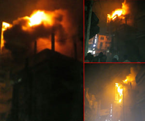 man burnt in fire