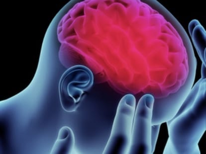 mobile app for brain stroke.