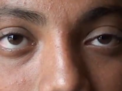 boy viberate eye ball and made golden book of world record