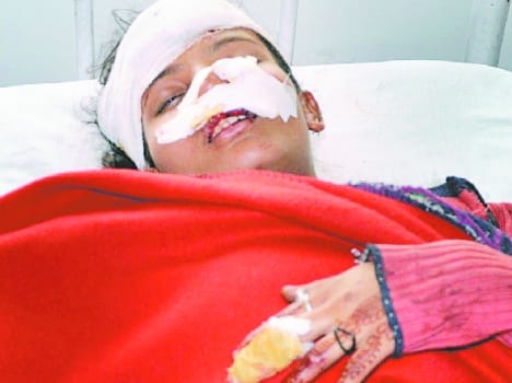 boy crushed two people under car.