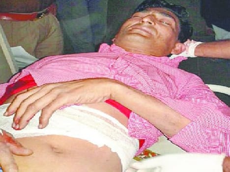 histrishiter ko goli mari