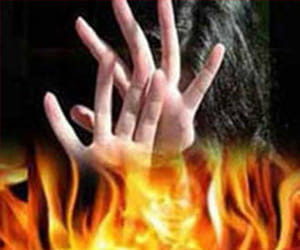 kids and youth burned on diwali 