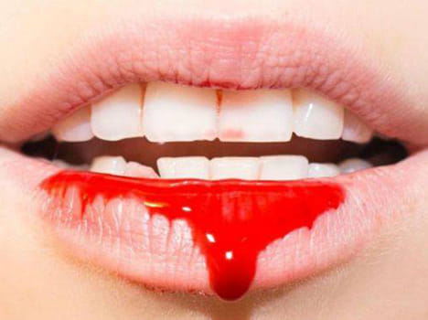 blood sucking humans and their story