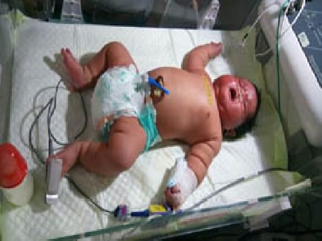 country's most weighted child born in jalaun, doctor excited