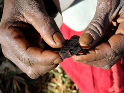 procedure through which fgm is carrieed