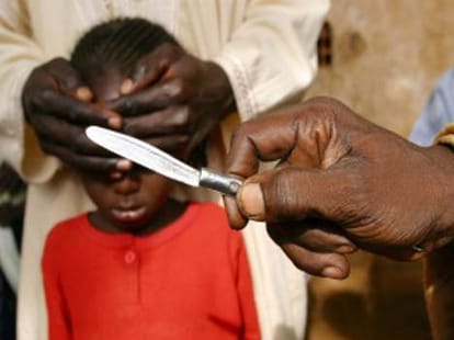 procedure through which fgm is carrieed