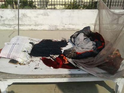 two in police custody on banaras acid attack case