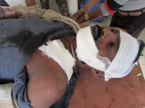 Rural injured by the tigress