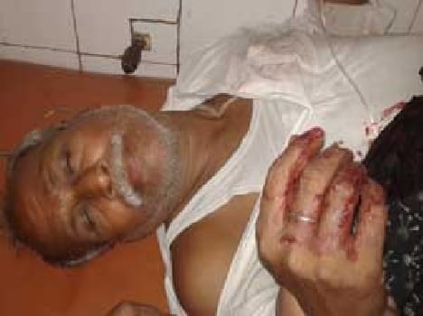 During the election campaign lasted shot, two injured