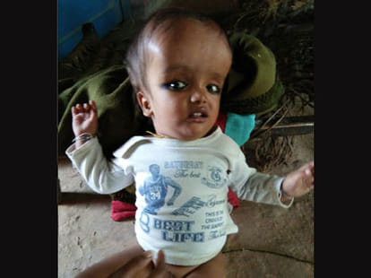 Two year old child's head bigger than a man.