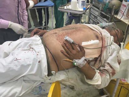 in Sons battle property dealer firing on policeman
