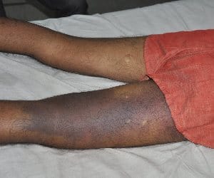 carelessness of doctor in lucknow
