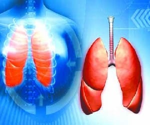 docters investigate teenager suffering from TB on instructions of cm.