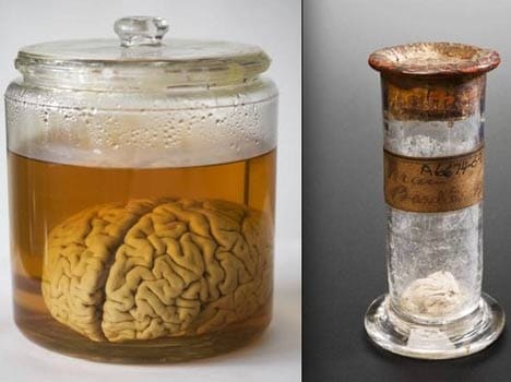 thief stole brains from medical museum and sold them on eBay