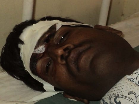 Five injured in road accident