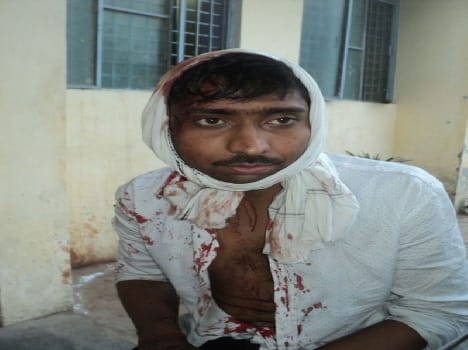 Kusma candidates clashed in Kheda, stones and firing