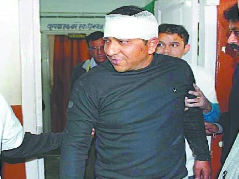 Pithoragarh ADM injured in road accident 