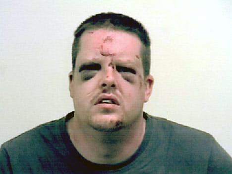 rape victim beaten up to rapist and bit his tongue