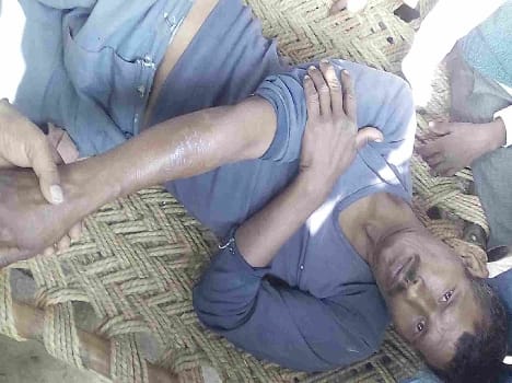 Attack on police in dura