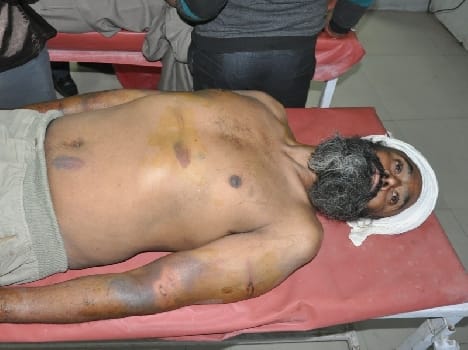 injured man found in train
