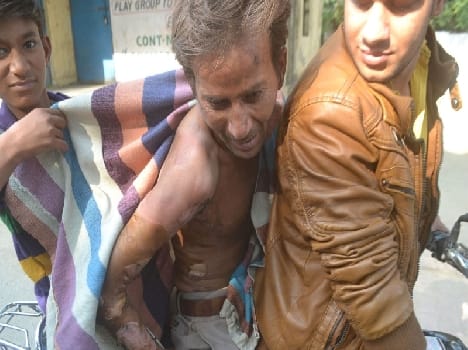  The young man attempted self-immolation