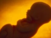 undeveloped fetus found in canal