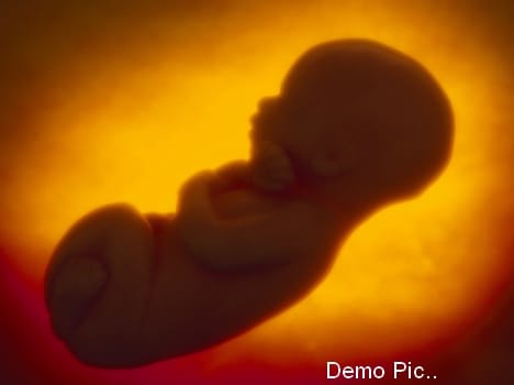 five month old fetus found in hospital toilet 