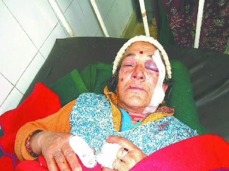 BJP leader's mother entered the house attacked 