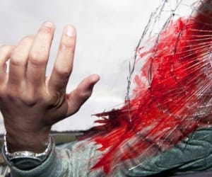 car accident of a girl in sitapur