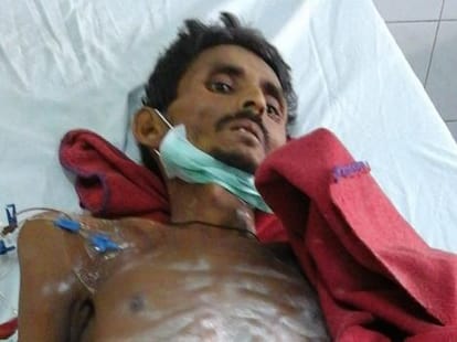 Carelessness of hospital leads a patient in a pathetic condition.