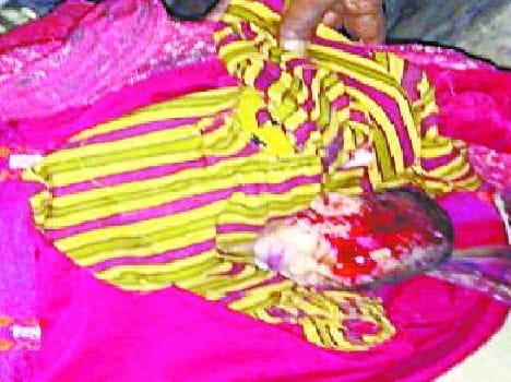 He won the battle of life unwanted newborn
