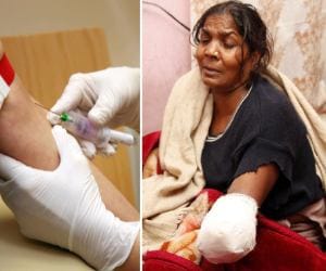 negligence of Clinic's woman's hand chopped