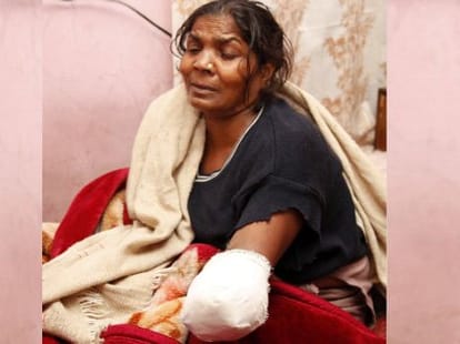 negligence of Clinic's woman's hand chopped