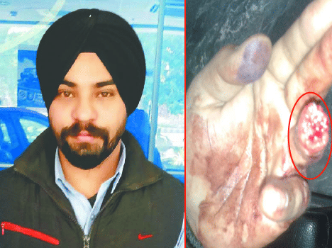  DTC bus driver was chewing man's finger.