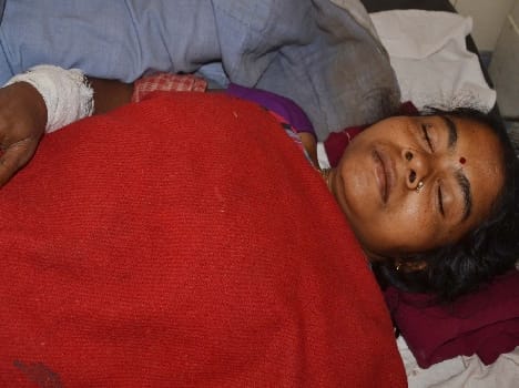 Leopard attack Woman injured