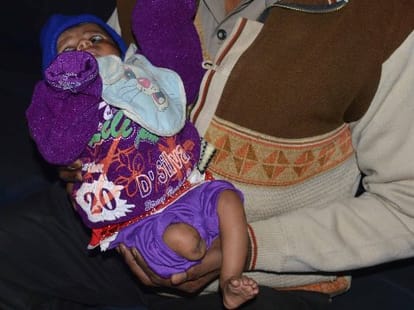 Carelessness of doctors creates trouble for girl child.