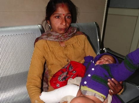 plaster on left leg in place of right broken leg in udhampur