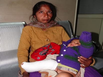 plaster on left leg in place of right broken leg in udhampur
