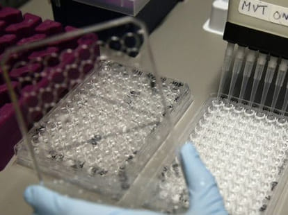 kidney may be failed on working hours in kitchen