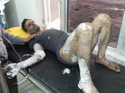 blast in jama masjid at kotdwar, one injured.