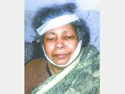 new turn in the case of beating mother in law