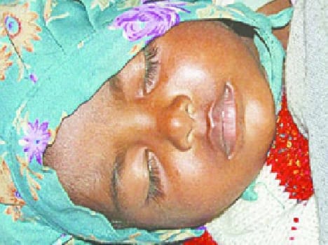 Jatropha havoc on children in Kapasa