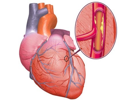 now american experts claims that cholesterol is not dangerous
