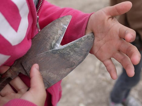 child refuses to work in the field, hand cut
