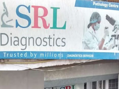 dispute over SRl testing laboratory
