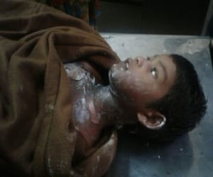 child put himself on fire.