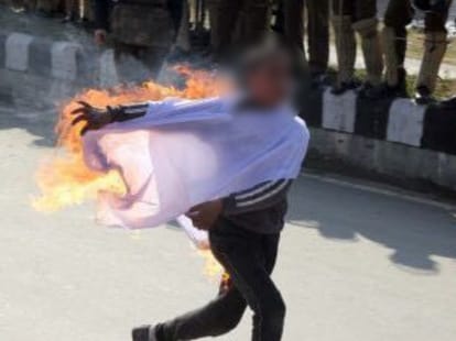 The self-immolation attempt by minor