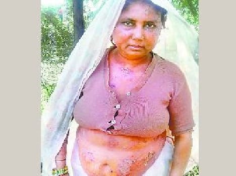 arsenic in water made the people unattractive