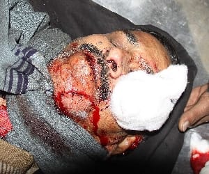 Two injured accident