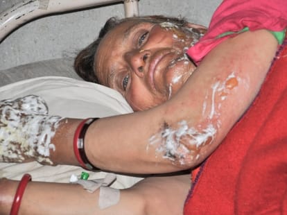 woman burned in fire rampur himachal pradesh